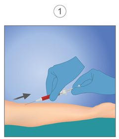 Illustration of blood being drawn from patient's arm.
