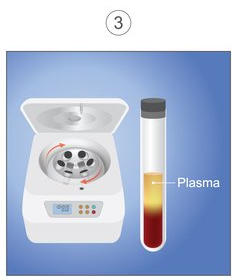Illustration of centrifuge machine and a tube of blood with the plasma separated out.