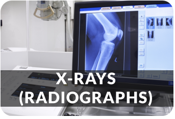 X-RAYS(RADIOGRAPHS)
