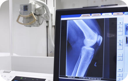 An x-ray machine with a screen showing an image of an x-ray of a patient's knee.
