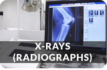 X-RAYS(RADIOGRAPHS)
