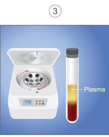 Illustration of centrifuge machine and a tube of blood with the plasma separated out.