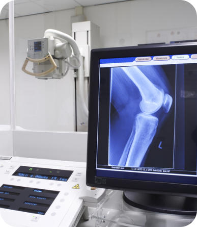 An x-ray machine with a screen showing an image of an x-ray of a patient's knee.